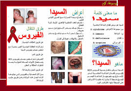 مرض السيدا اعراض واسباب مرض السيدا عبارات