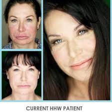 THE BEST 10 Nutritionists in ROWLETT, TX