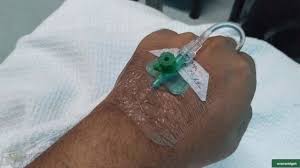 Check spelling or type a new query. Cucuk Jarum Branula Pada Urat Salur Darah Untuk Masuk Air Youtube