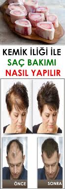 Sac Dokulmesi Icin Kemik Iligi Bakimi Nasil Yapilir Vipbakim Kemik Iligi Ev Yapimi Cilt Bakimi Sac Bakimi