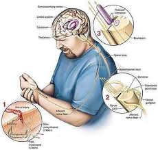 Complex Regional Pain Syndrome Treatment Top Doctors Brooklyn Nyc