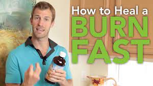 How To Ease A Burn Fast - Youtube