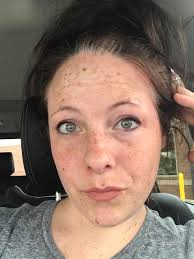 MC bad hair day issue in Love and Deepspace game