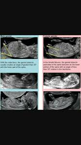 I hope you guys enjoy the beautiful moment when we. Pin On Obstetricia