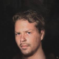 Chin goatee with soul patch & detached mustache: How Would Young James Look Like Without His Iconic Beard And Hairstyle Metallica