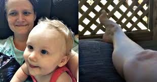 Chronic Regional Pain Syndrome: one woman's story of 'suicide disease'.