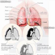 Maybe you would like to learn more about one of these? Ù…Ø¯Ùˆ Ù†Ø© Ø§Ù…Ø±Ø§Ø¶ Ø¬Ù‡Ø§Ø² Ø§Ù„ØªÙ†ÙØ³ Ø¹Ù†Ø¯ Ø§Ù„Ø£Ø·ÙØ§Ù„ Ù…Ø¬Ù„Ø© Ø§Ù„Ø±ÙŠØ§Ø¶Ø© Ùˆ Ø§Ù„ØµØ­Ø©