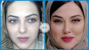 لیلا اوتادی قبل از عمل زیبایی