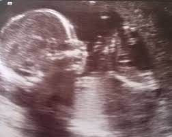 Cinsiyet testi fox tv anahaber'de. Bebegin Cinsiyeti Ne Zaman Belli Olur Kiz Mi Erkek Mi