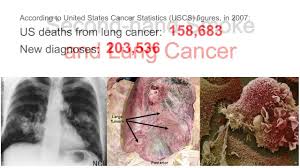 Kids who breathed secondhand smoke for many hours every day were 3.6 times more likely to. Can A Child Get Lung Cancer From Secondhand Smoke Joe Gaeta Don T Smoke You Could Still Get Lung Cancer Wheezing And Coughing Are More Common In Children Who Breathe Secondhand