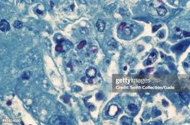 Image result for Filoviridae