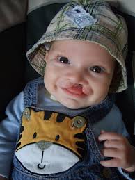 The Finlay Parkinson Cleft Lip & Palate support group