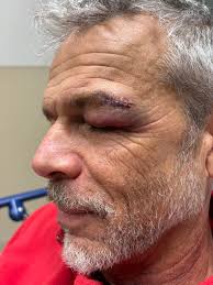 Kite Surfer's Solo Accident and Fox Sighting at Spermaceti Island