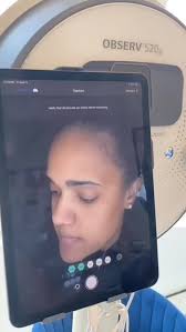 💉Your lips just enhanced, never overdone. Leanne and Laura have been  diligently addressing the increasing demand for lip enhancements within our  clinic. Utilising only licensed, medical-grade dermal fillers, each  treatment is meticulously