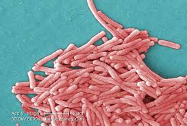 Legionnaires' disease is a form of atypical pneumonia caused by any species of legionella bacteria, quite often legionella pneumophila. Legionellosis Legionnaires Disease And Pontiac Fever Overview Occupational Safety And Health Administration