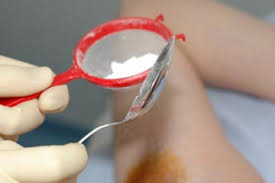 Image result for Sweat Chloride