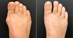 Foot/Ankle Pain