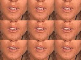 Erik hoy ­long before anyone thought to nip and tuck or even heard of. Plastic Surgery Gifs Wifflegif