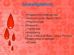 Image result for Progesterone Challenge Test
