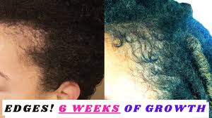 These oils reduce damage to your edges by repairing the follicles and encouraging hair growth. How To Grow Your Edges Back Brandi Cohen