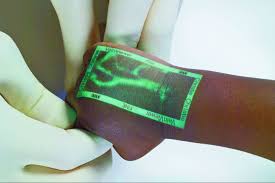 Passive vein finders are another option. Brilliant Veinviewer Makes It Easier And Less Painful To Find A Patient S Vein