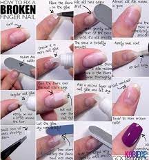Una Rota3 Artandnails Fix Broken Nail Broken Nails Nails