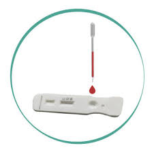 Alibaba.com offers efficient and precise rapid test cassette quick biotech for all types of machinery, bacteria, seeds, etc. Igg Igm Antibody Test Serological Wiz Biotech Labevolution
