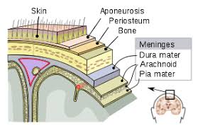 Meningitis Wikipedia