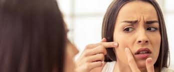 Sivilce Akne Neden Olusur Sivilce Nasil Gecer