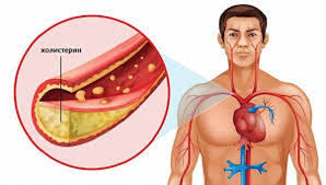 Kak Snizit Holesterin V Krovi V Domashnih Usloviyah Bystro I Effektivno Normalizaciya Urovnya Holesterina V Organizme Informacionnyj Portal