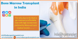 Reasons Behind The Development Of Bone Marrow Transplant In India Bone Marrow Stem Cell Transplant Transplant