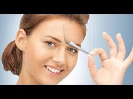 Haz Tu Crema De Azufre En Casa Elimina Acne Crece Tus Cejas Y Suaviza Tu Piel Acne Remedios Caseros Como Quitar El Acne Remedios Para El Acne