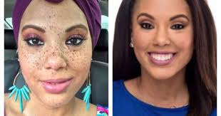 Houston Reporter Reveals 'Off Day' Freckles