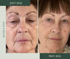 Free skincare analysis and routine for healthy skin