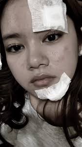 Treatment Electra Leslie