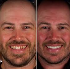 Grants Ferry Family Dentistry