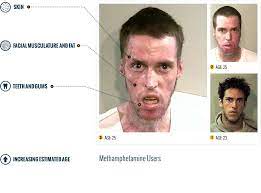 Before And After Drugs Meth