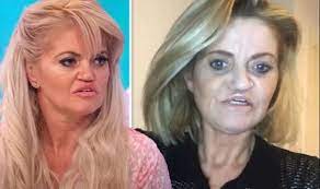 See all books authored by danniella westbrook, including other side of nowhere, and faith, hope and clarity, . Danniella Westbrook Undergoes The First Of Four Surgeries To Repair Rotting Away Jaw Celebrity News Showbiz Tv Express Co Uk