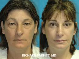 Appleton plastic surgery center, sc. Pin On Interesting