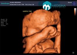 + 60 6 763 0105. Klinik Medisina Posts Facebook