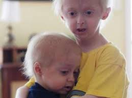 Montco brothers with fatal aging disease, progeria, find hope in new drug,  the kindness of a stranger