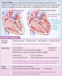 Heart Failure Heart Failure Heart Failure Nursing Heart Failure Treatment