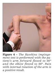 Image result for Hawkins Test
