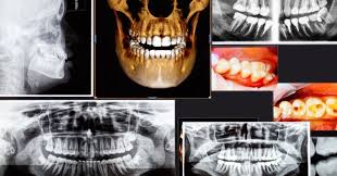 Maybe you would like to learn more about one of these? Starbrite Dental Able To Take 3d X Rays With Cone Beam Ct Scanner