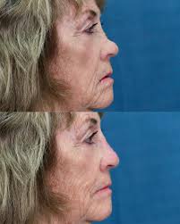 Dr. Adam Aronson, MD (@dr.adam_) • Instagram photos and videos