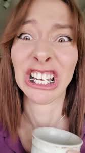 Herbstscharnier: Alles über Kieferorthopädie und Zahnspangen