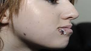 Canterbury College student Evie White describes the moment she was shot in  the face with a crossbow