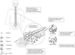 The solenoid then closes the b rake f l uid port and allows the trailer to back up without locking. The Mechanisms Involved In Spinal Cord Injury Spinal Cord Injury Can Download Scientific Diagram