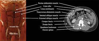 Several additional pelvic and hip muscles are better introduced as part of a lower extremity lab, but since they are so well seen here we will look at them. Imaging Of Abdominal Wall Masses Masslike Lesions And Diffuse Processes Radiographics