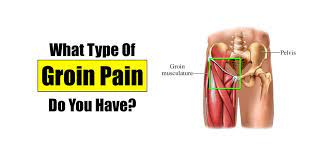 Your hip joint is found along the same line underneath your groin. What Kind Of Groin Pain Do You Have Squat University